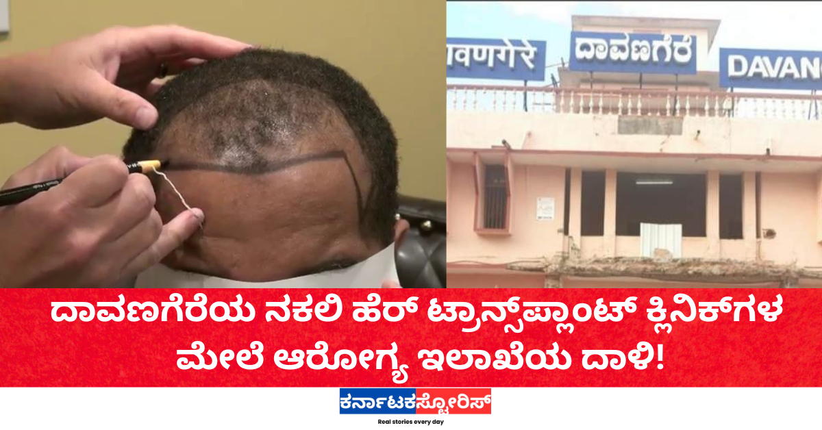 ದಾವಣಗೆರೆಯ ನಕಲಿ ಹೆರ್‌ ಟ್ರಾನ್ಸ್‌ಪ್ಲಾಂಟ್‌ ಕ್ಲಿನಿಕ್‌ಗಳ ಮೇಲೆ ಆರೋಗ್ಯ ಇಲಾಖೆಯ ದಾಳಿ!