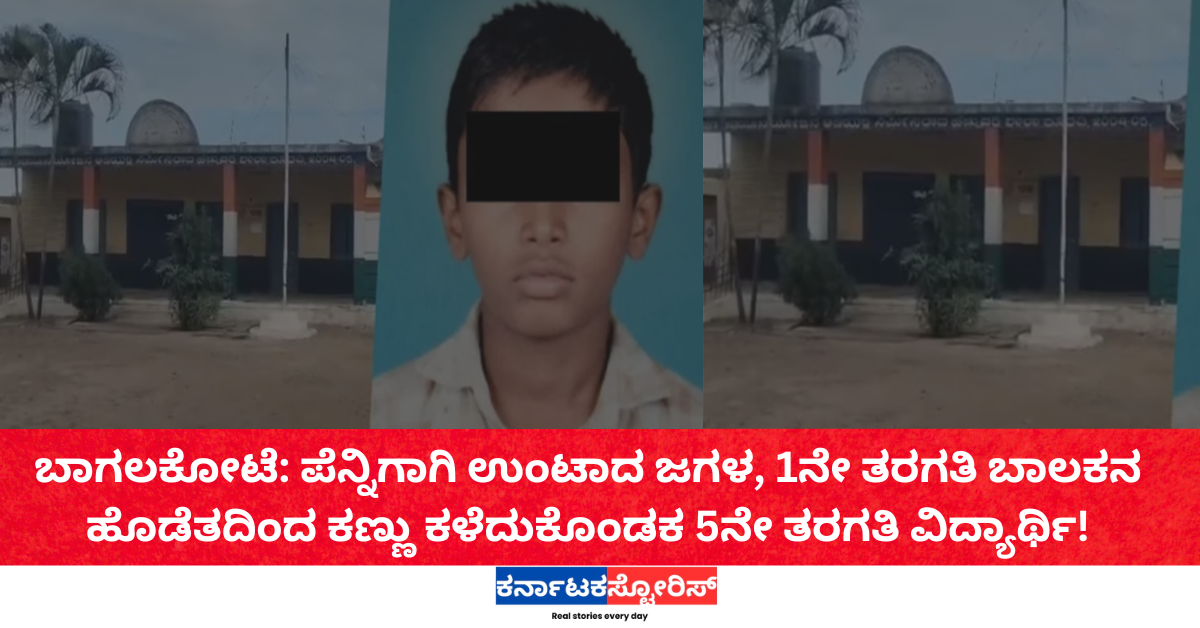 ಬಾಗಲಕೋಟೆ: ಪೆನ್ನಿಗಾಗಿ ಉಂಟಾದ ಜಗಳ, 1ನೇ ತರಗತಿ ಬಾಲಕನ ಹೊಡೆತದಿಂದ ಕಣ್ಣು ಕಳೆದುಕೊಂಡಕ 5ನೇ ತರಗತಿ ವಿದ್ಯಾರ್ಥಿ!